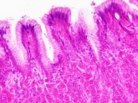 nabir-preparativ-bresser-30-pcs-box-histology-fotofox.com.ua-5.jpg